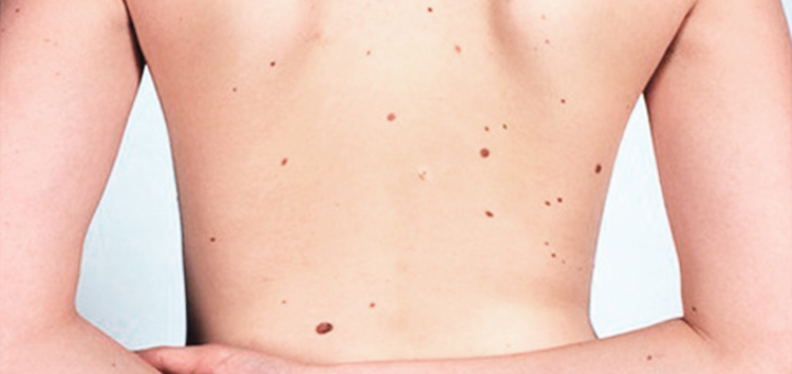 Dermatología