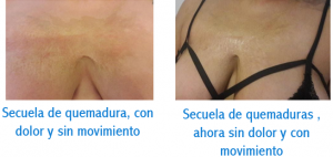 Fisioterapia Dermatofuncional